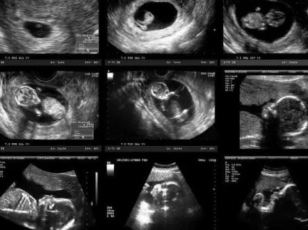 唐山妇幼保健院试管婴儿成功率参考，一次好孕并非在做梦