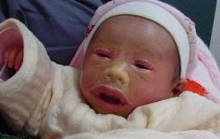 在耒阳市做试管婴儿长方案周期需要多久？超长方案促排流程是怎么样的？